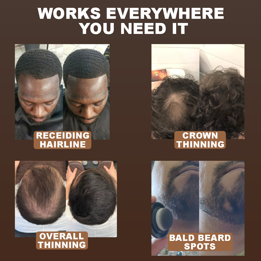 HoldTrue Scalp & Hair Concealer